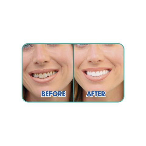 immagine-4-best-direct-spazzolino-da-denti-ad-ultrasuoni-ean-0644812053917