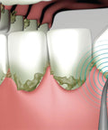 immagine-7-best-direct-spazzolino-da-denti-ad-ultrasuoni-ean-0644812053917